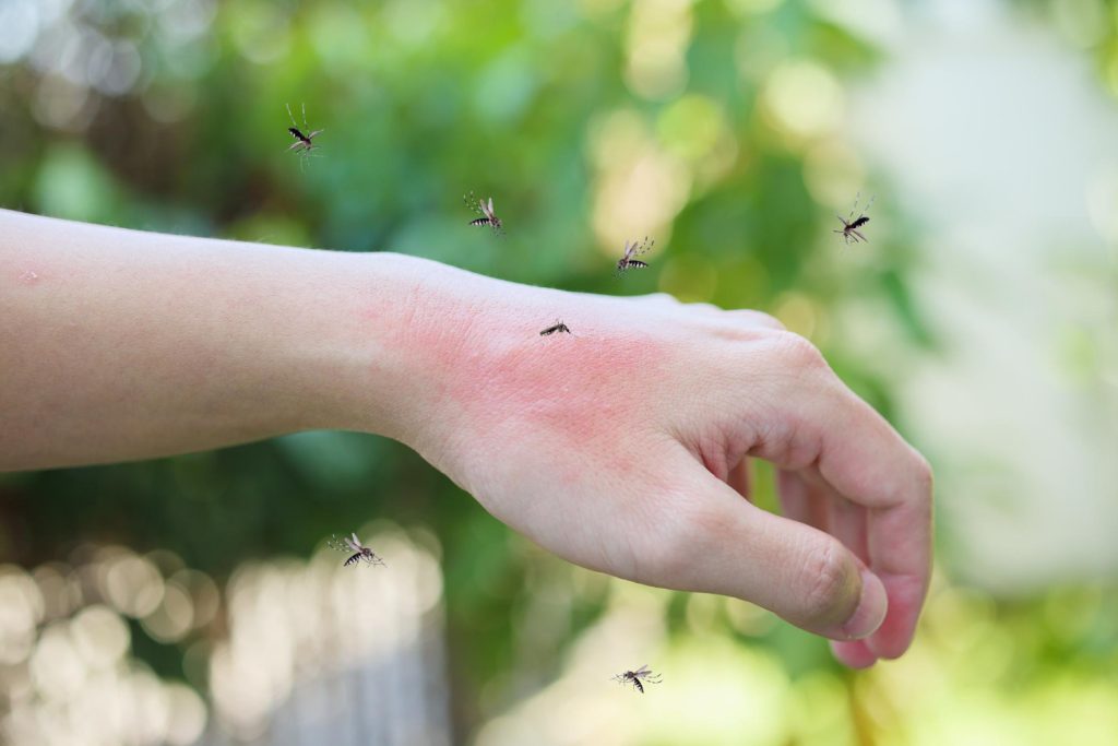 Quick Weekend Mosquito Control Tips